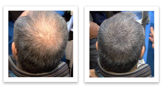Poza before and after aplicarea fibrelor de par reale din keratina Hairify