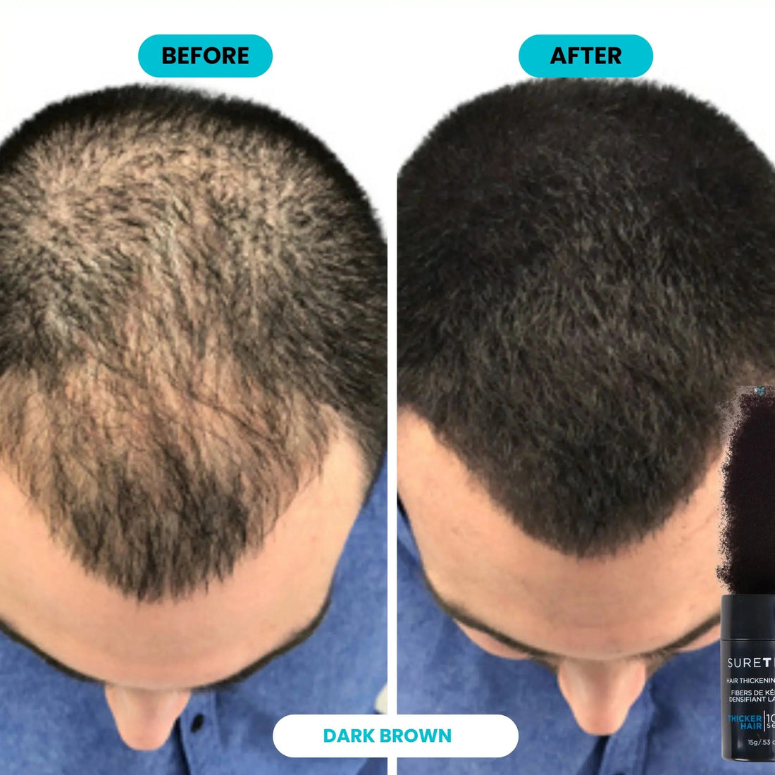 Before and After utilizarii fibrelor de par Hairify