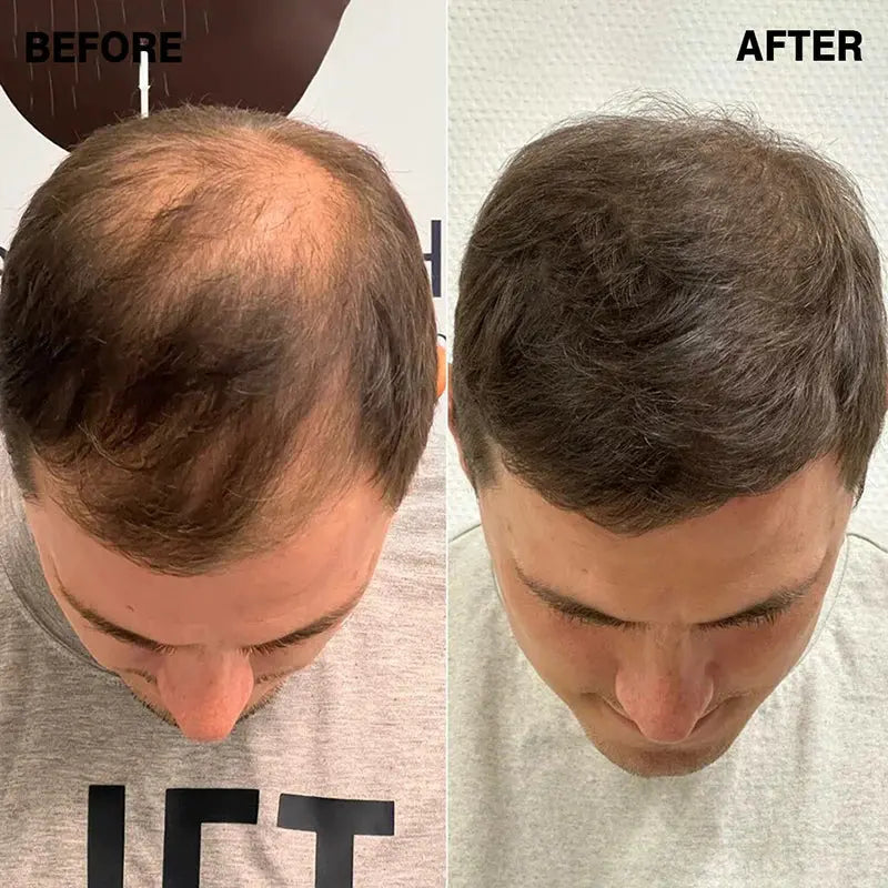 Hairify – Fibre de păr (27.5 Grame - pentru aproximativ 2 luni)