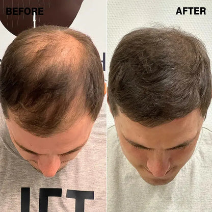 Hairify – Fibre de păr (27.5 Grame - pentru aproximativ 2 luni)